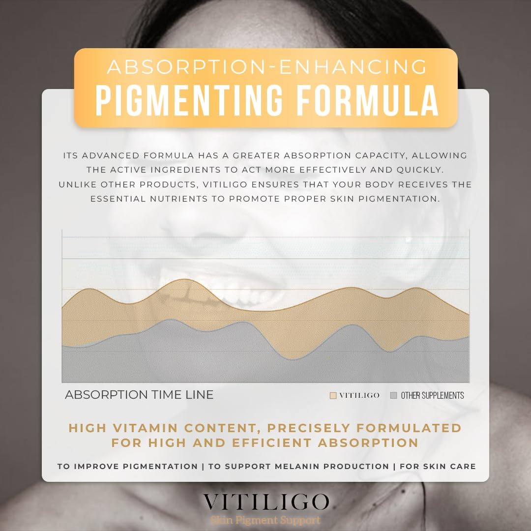 Natural Vitiligo Supplement Capsules | Reduce White Spots, Improve Skin Pigmentation | Dermawonder Vitiligo Support | 60 Count, All Skin Types