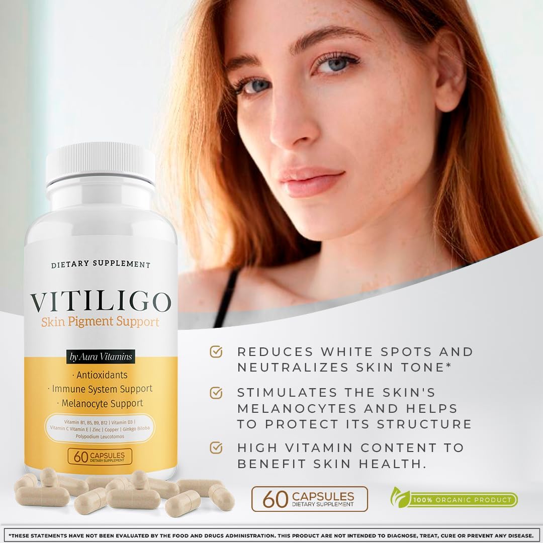 Natural Vitiligo Supplement Capsules | Reduce White Spots, Improve Skin Pigmentation | Dermawonder Vitiligo Support | 60 Count, All Skin Types