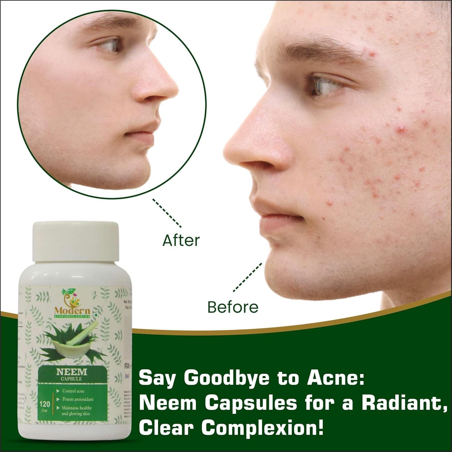 Organic Neem Capsules for Acne Control, Antioxidant Protection, and Healthy Skin - 120 Count