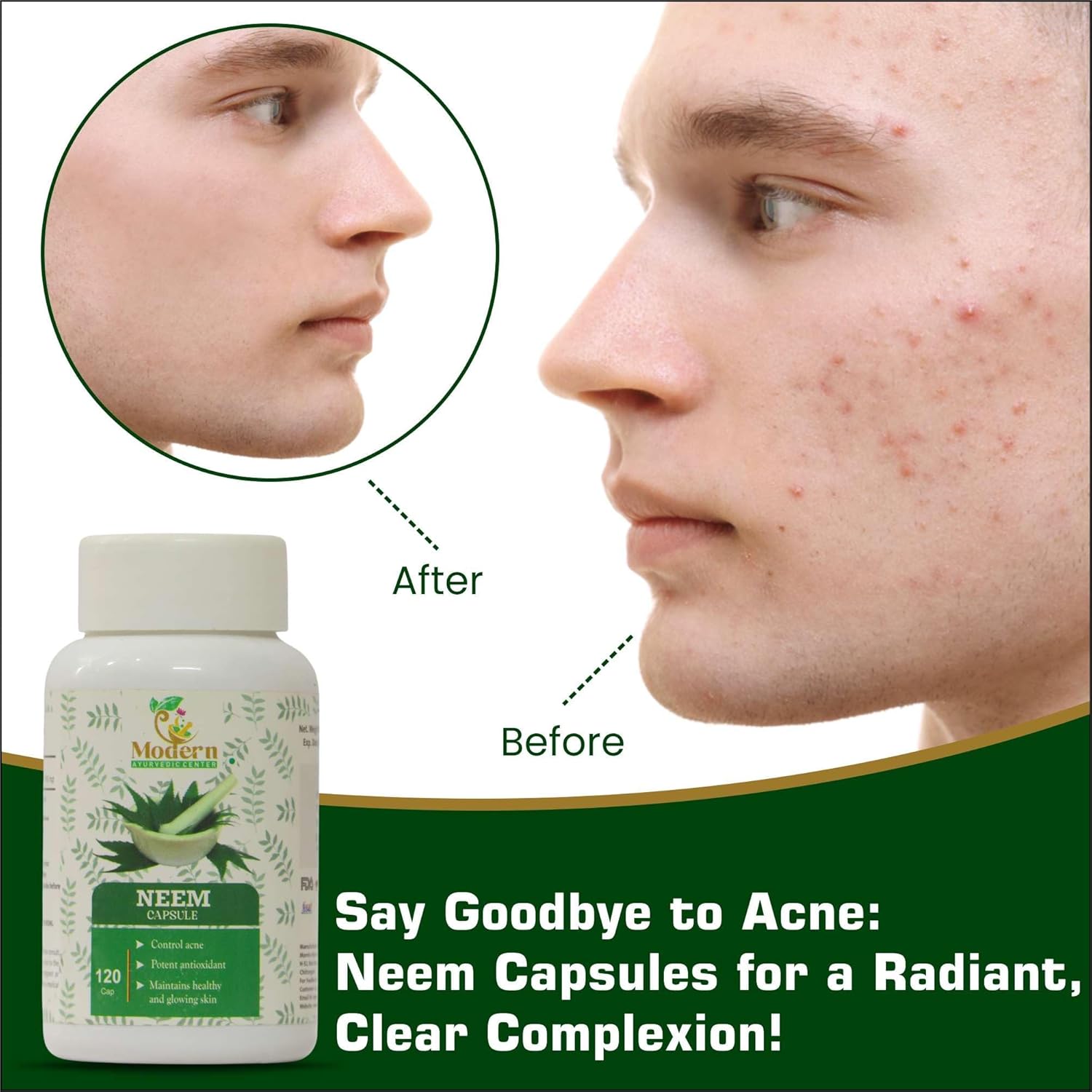 Organic Neem Capsules for Acne Control, Antioxidant Protection, and Healthy Skin - 120 Count