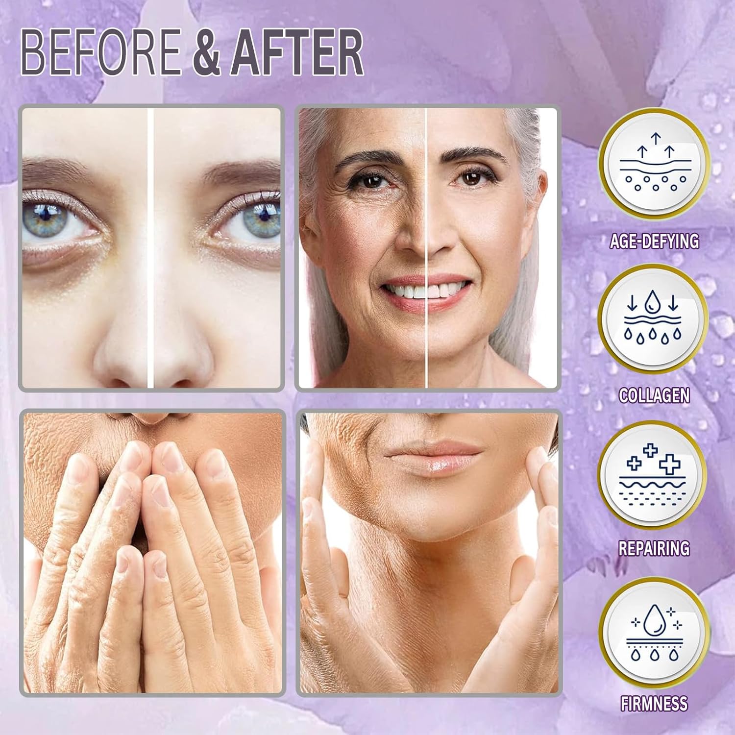 PHYMAT ACADA Face Lift PDO Threads Set - 26G60mm Mono & Smooth Threads for Thread Lift & Collagen Production - 20Pcs