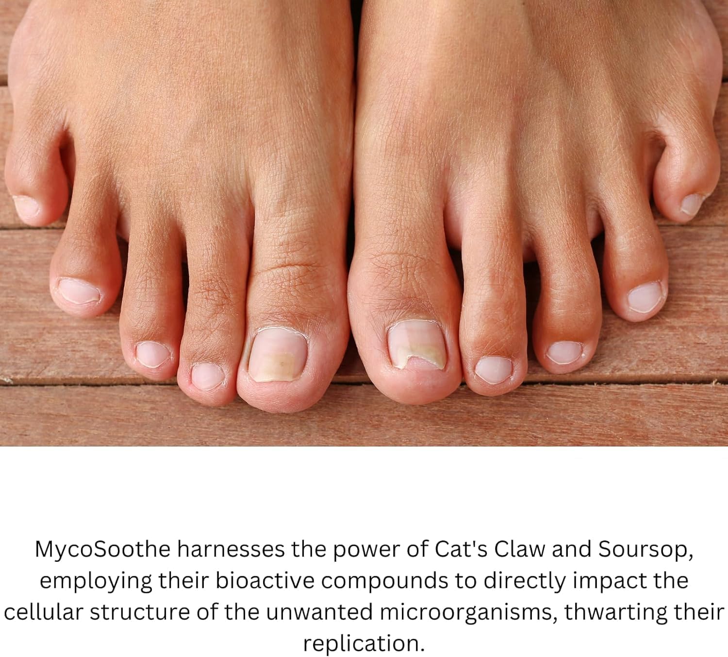 Phytage Labs MycoSoothe Advanced Hair, Skin, Nail & Immunity Support Formula - Buy 2 Pack Online
