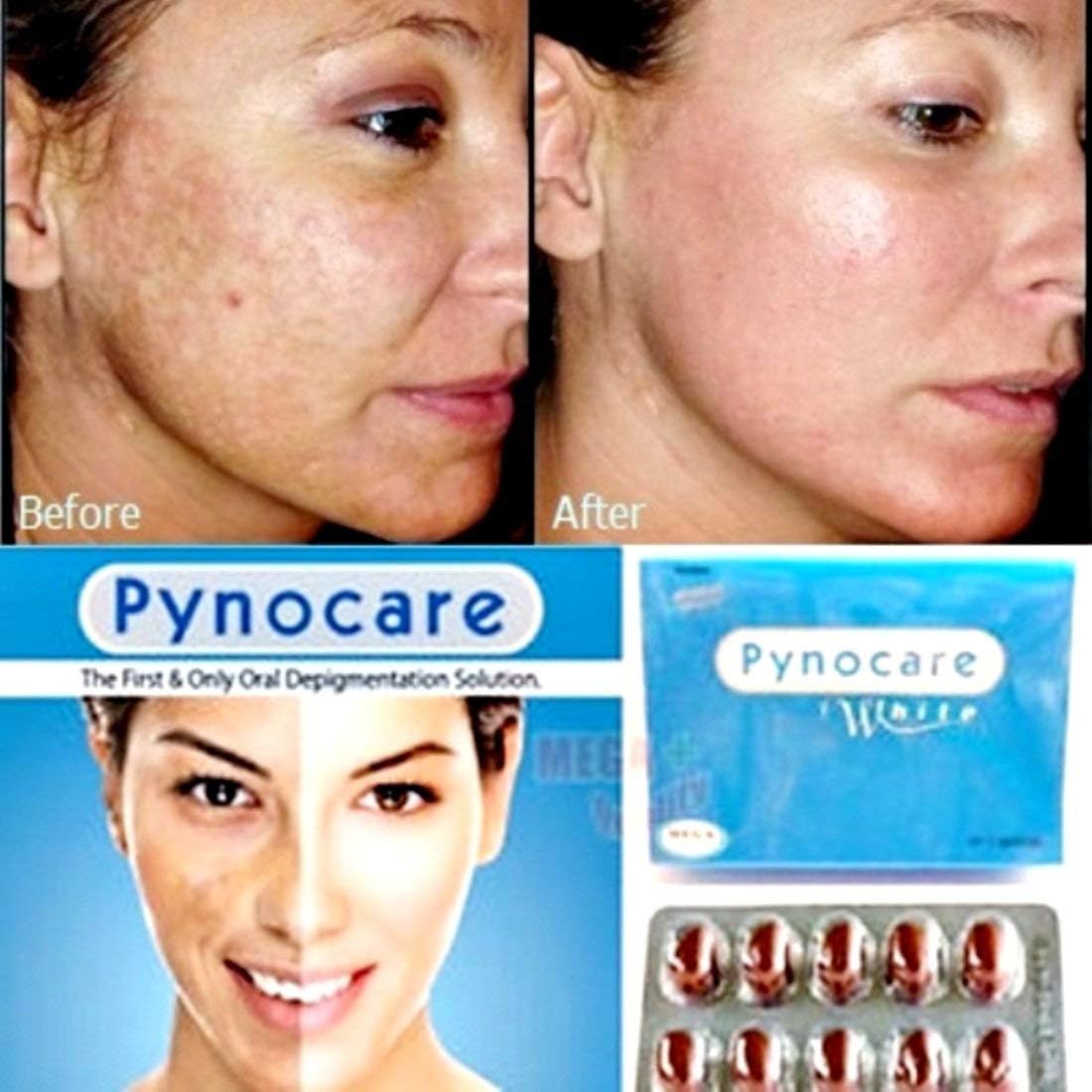 Pynocare White Melasma Treatment 20 Capsules - Mega Brands [Free Beauty Gift Included]