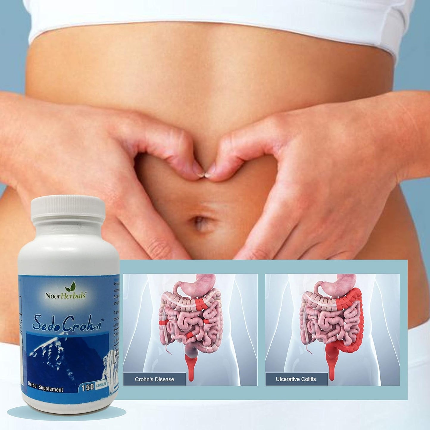 SedaCrohn - Natural Relief for Crohn's Disease and Ulcerative Colitis